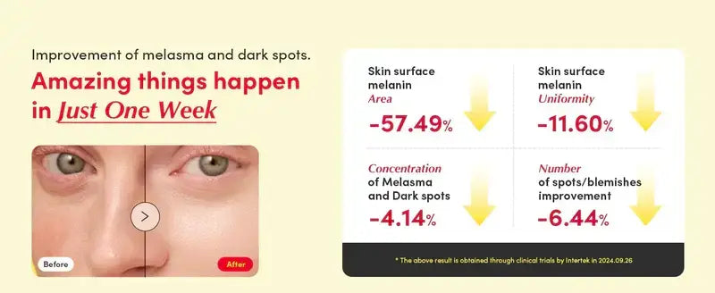 Zuzu Aura C Serum Vitamin visibly improves melasma and dark spots in just one week