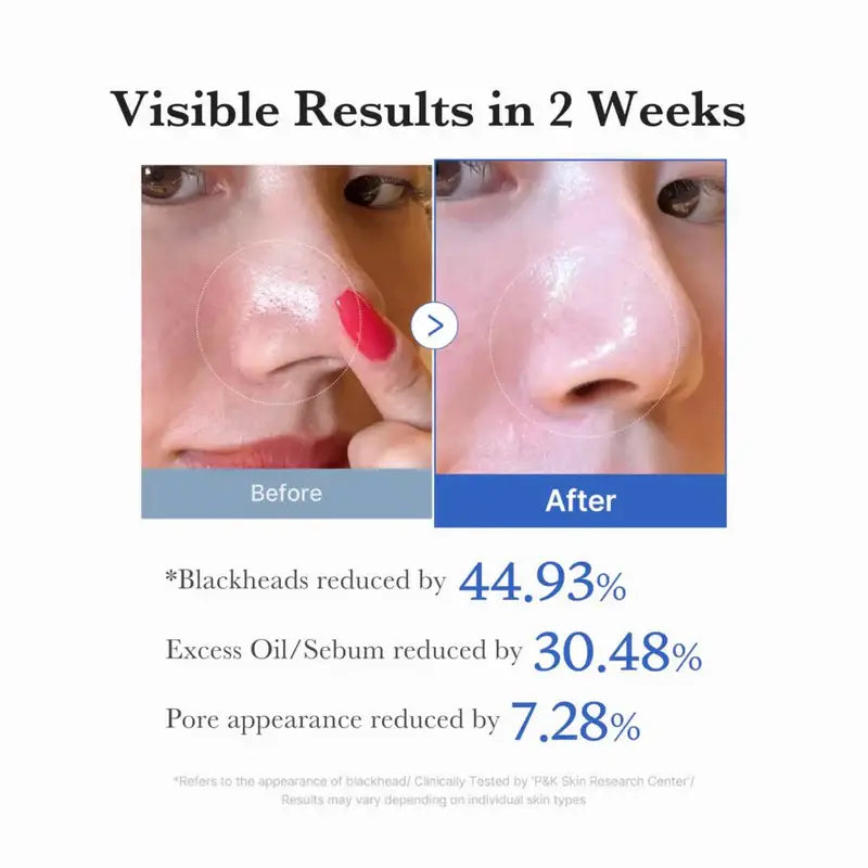 Medicube Zero Pore Pad 2.0 - 70 pads
