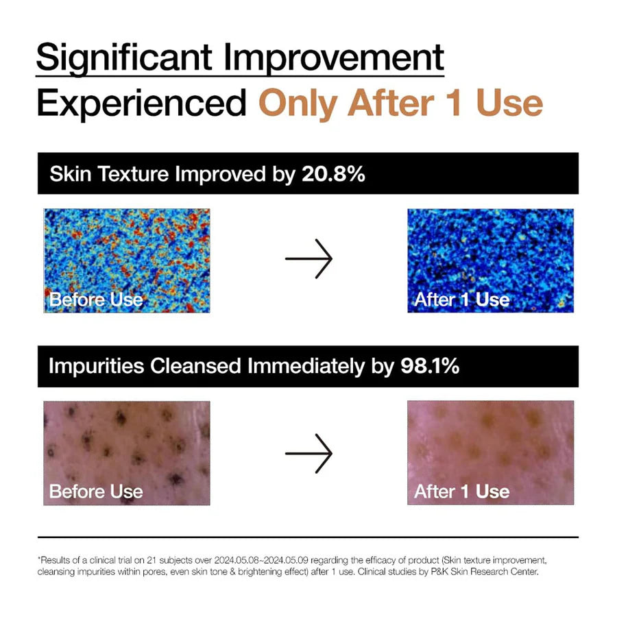 Anua rice enzyme cleansing powder clinical results showing improved skin texture and cleansed impurities after one use