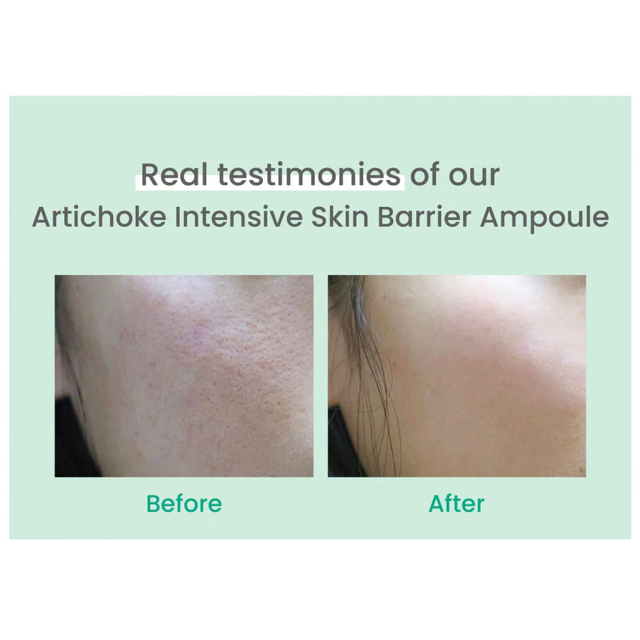 Before and after photos showing skin improvement using AXIS-Y artichoke skin barrier ampoule