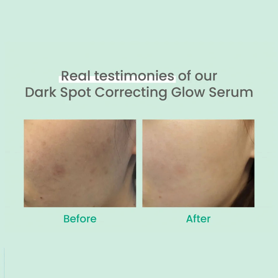Before and after comparison showing the effect of AXIS-Y dark spot correcting serum on facial skin