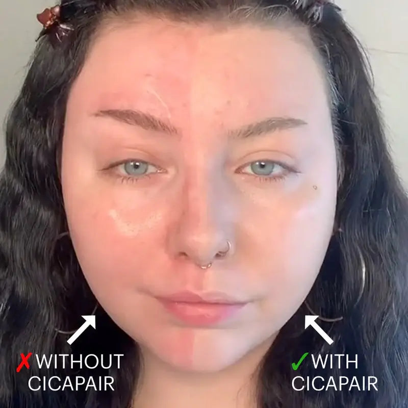 Before and after using Laura Geller color correcting foundation for flawless skin tone enhancement