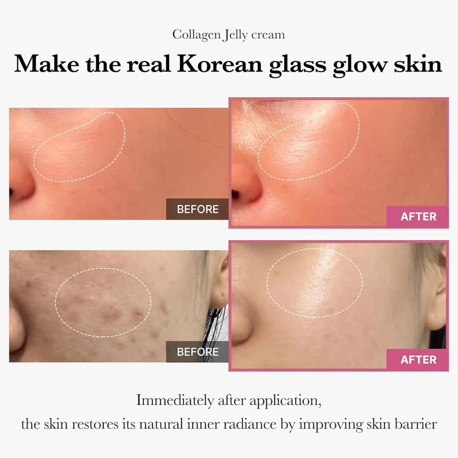 Medicube collagen jelly cream before and after images showing improved Korean glass glow skin with reduced blemishes and increased radiance