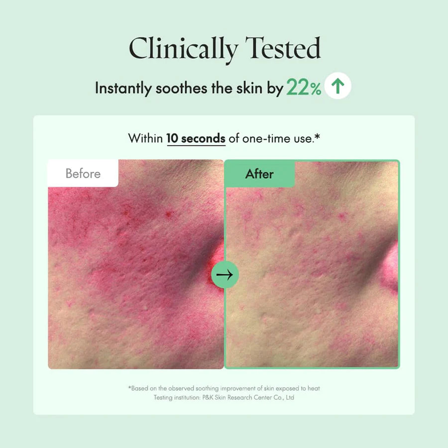 Before and after images showing skin soothing effect of PURITO fragrance free calming serum 60ml